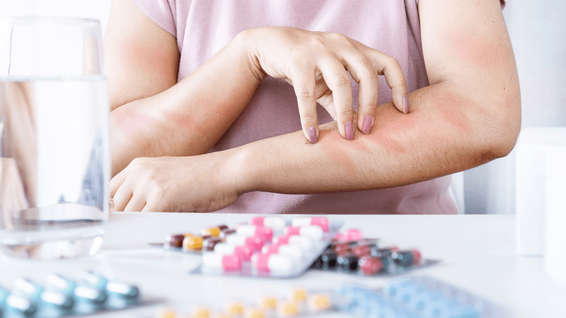 Alergia a Medicamentos: Entenda os Sintomas, Diagnóstico e Cuidados ...